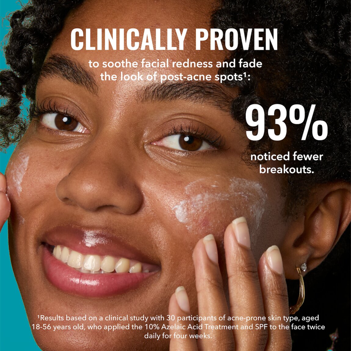 10-azelaic-acid-treatment-c4 zb_p.jpg