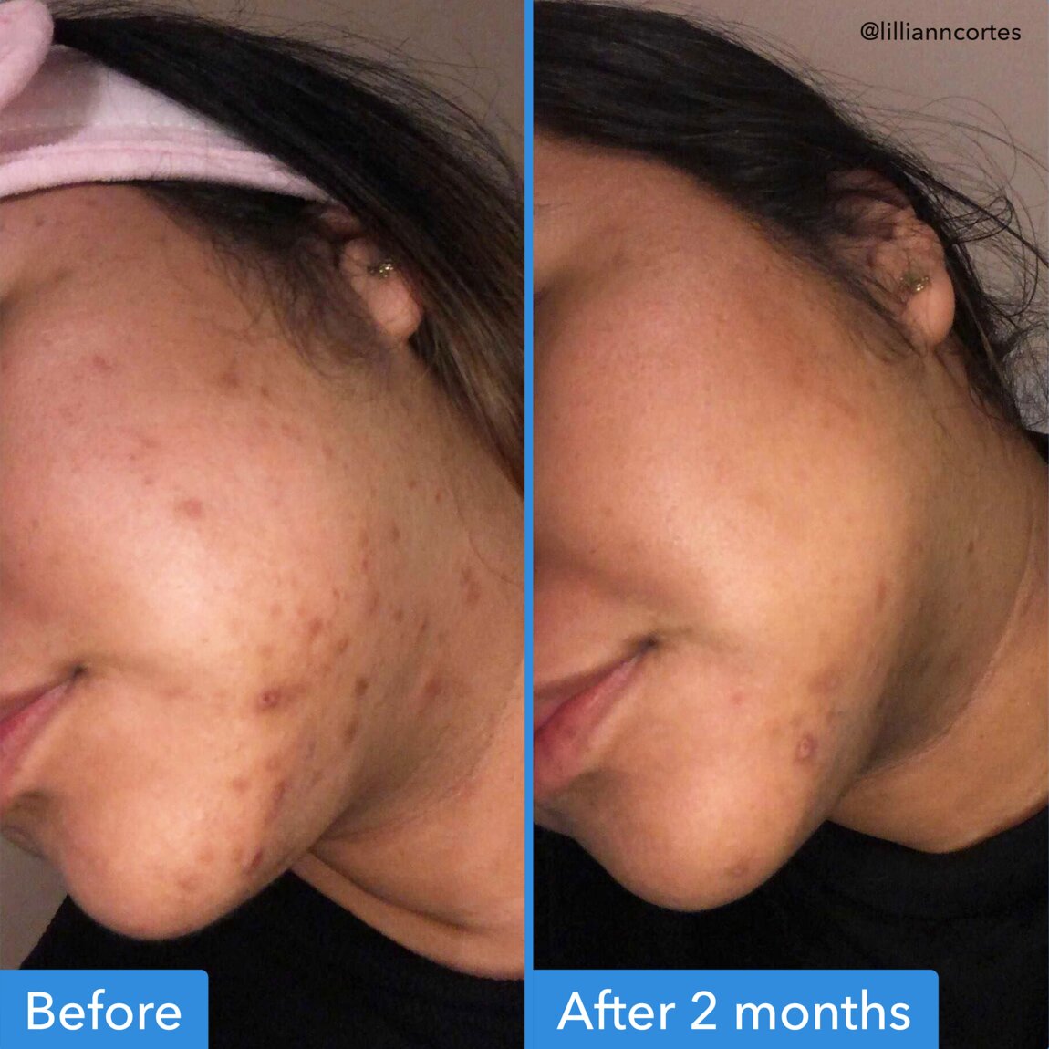 discoloration-correcting-serum-o9 zb_p.jpg