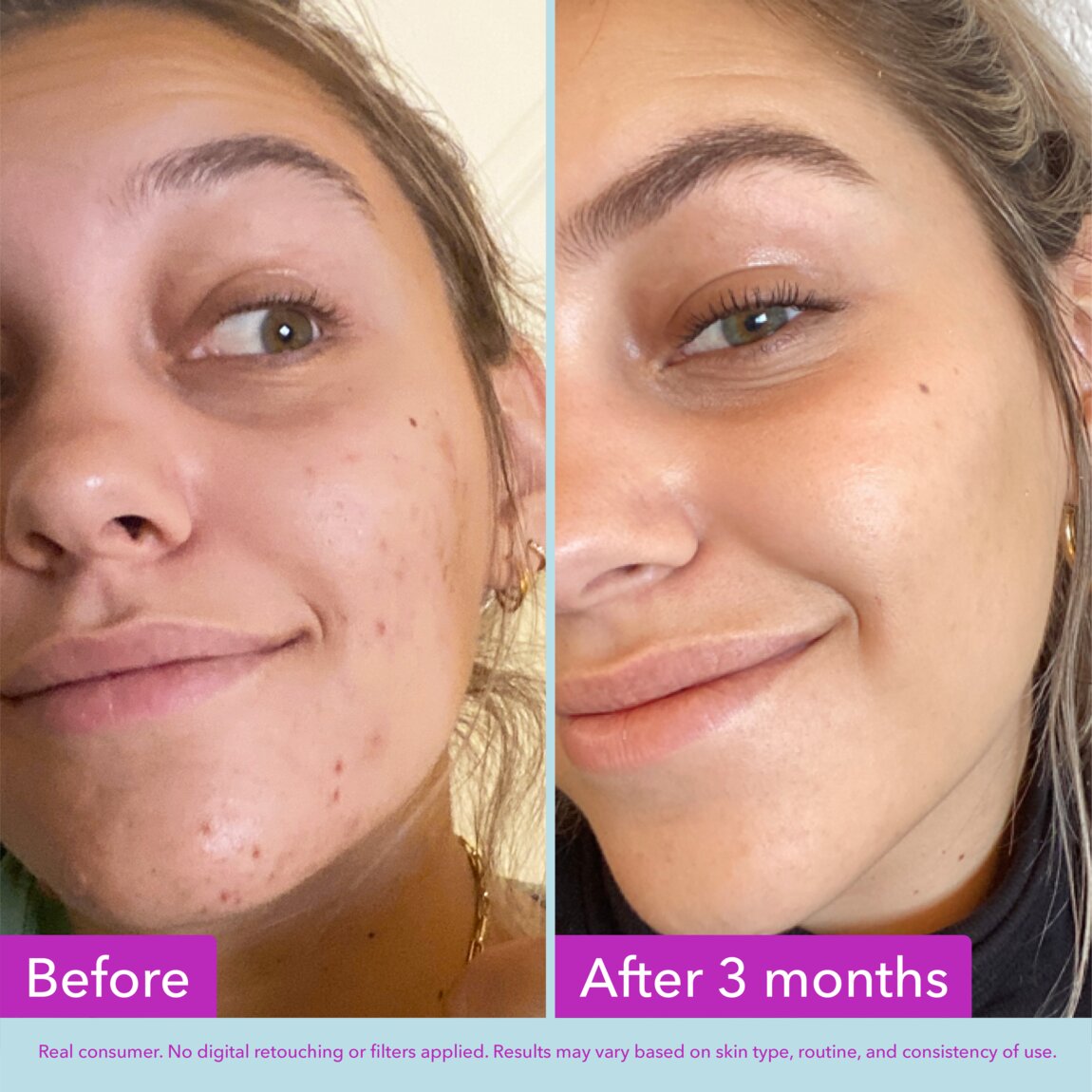 niacinamide-brightening-toner-v0 zb_p.jpg