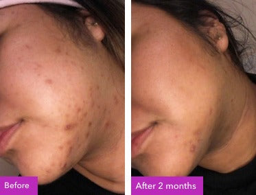 Before and after two months